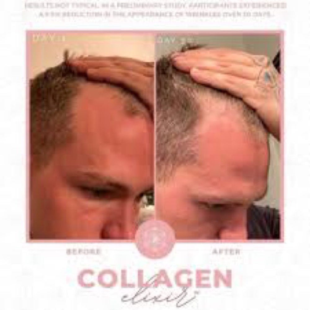 COPY - Collagen Elixir - Picture 9 of 11